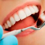 empastes dentales adeslas: ventajas de usar seguro dental privado